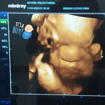 Aprince Malagae profile icon