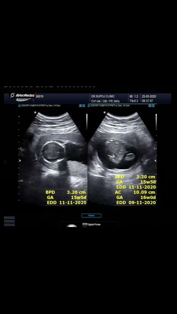 ใบซาวด์ไม่เคยตรงกันเลย