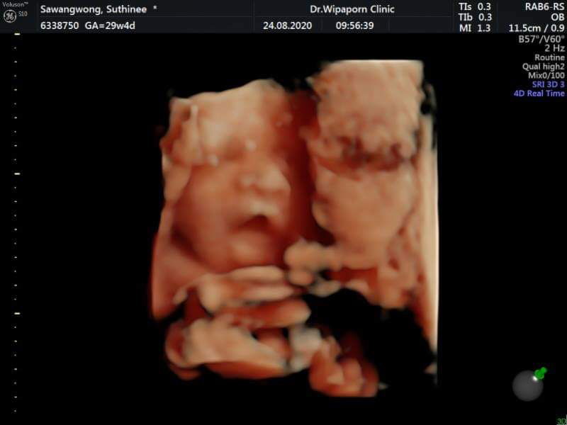 Suthinee profile icon