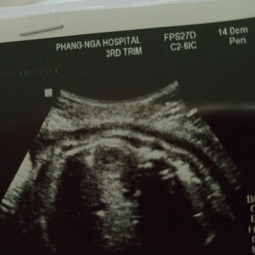 เพศลูก
