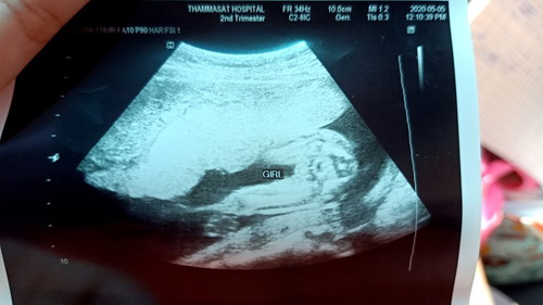 ผู้หญิงแน่ใช่มั้ยคะแบบนี้