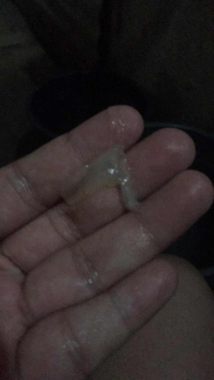 May lumabas na Mucos plug 35wks and 3days