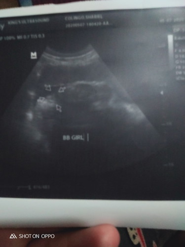 8months pregnant
