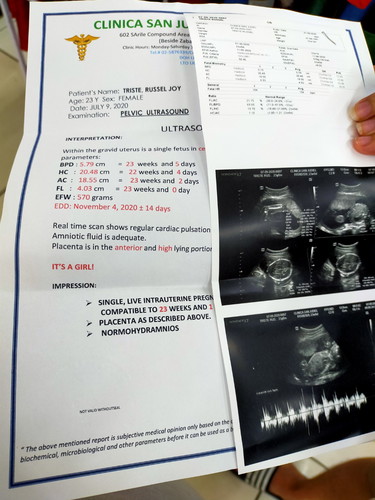 amniotic fluid