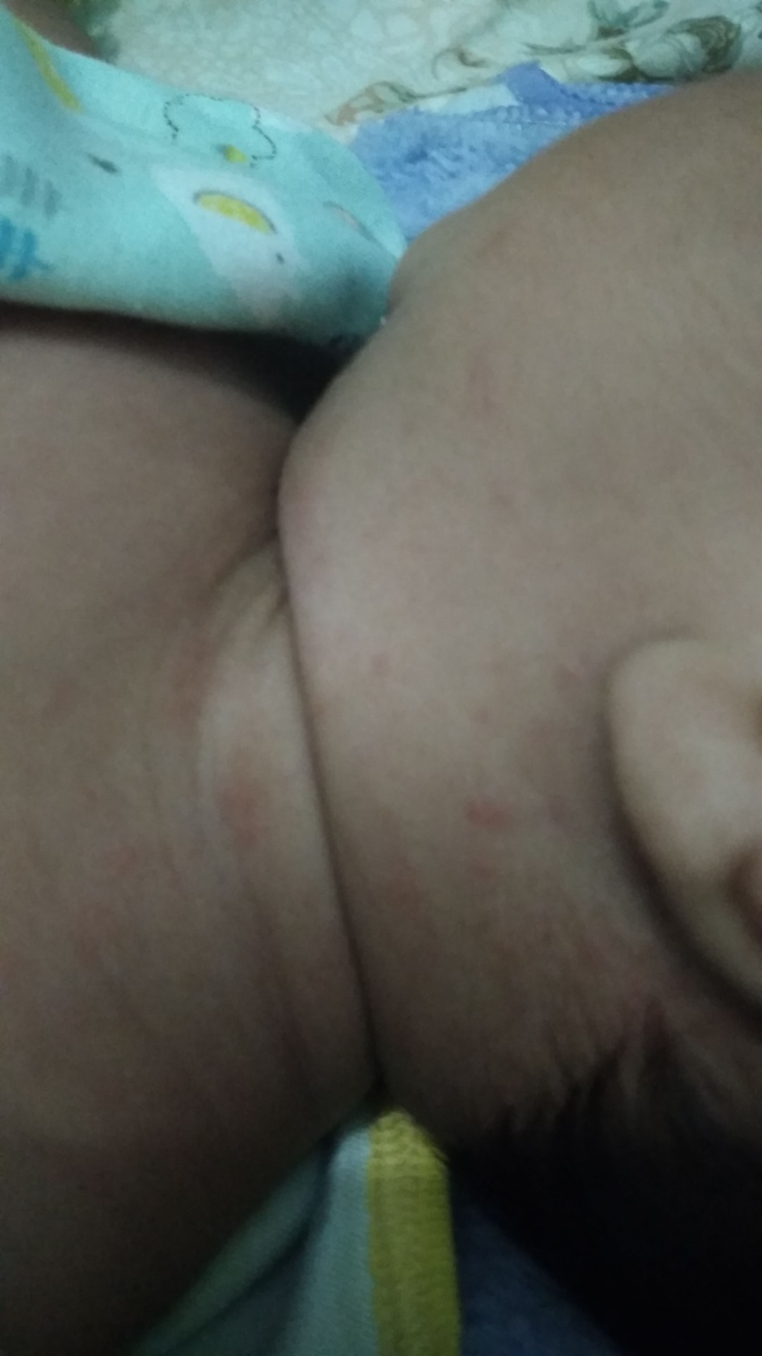 Biang keringat?