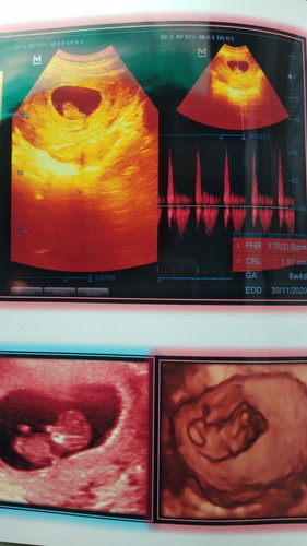 ไปหาหมอมา