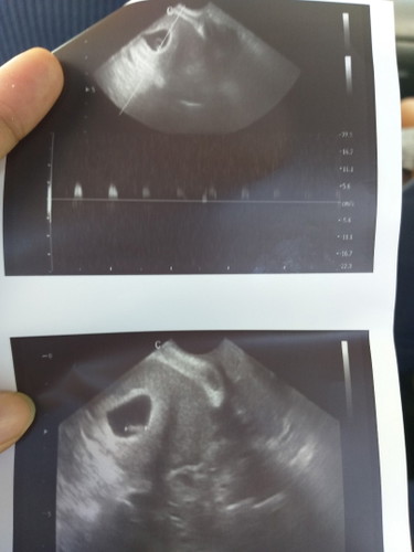 5weeks and 6days