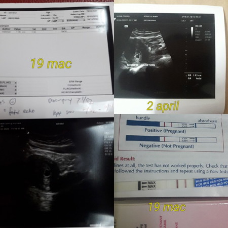 scan dan kantung kosong