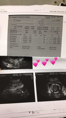 ทีมกันยา รู้สึกว่าลูกดิ้นหรือสะอึกแล้วบ้างค่ะ