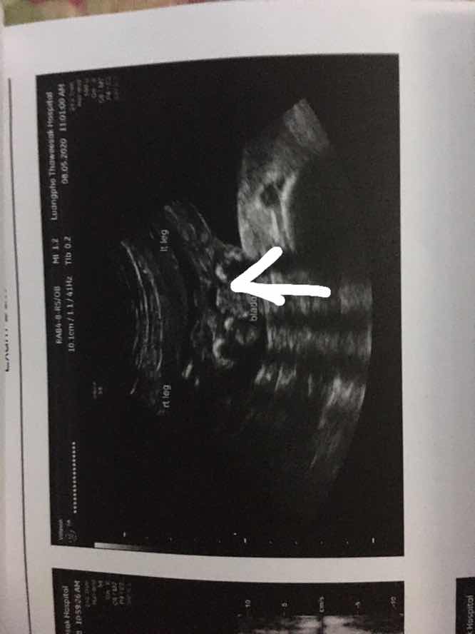 ซาวผิดพลาด