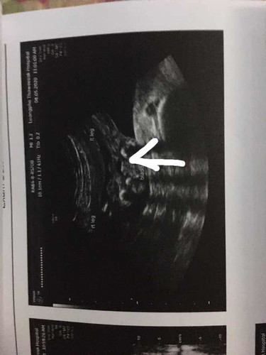 ซาวผิดพลาด