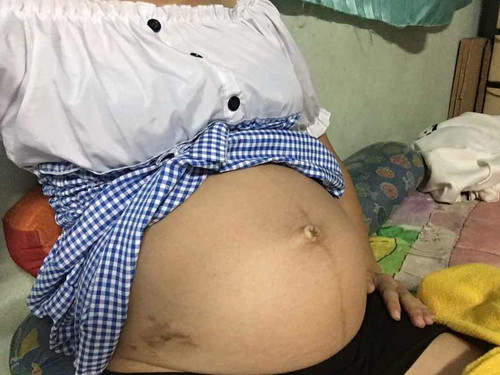 ทีมกันยาท้องใหญ่มั้ยคะ