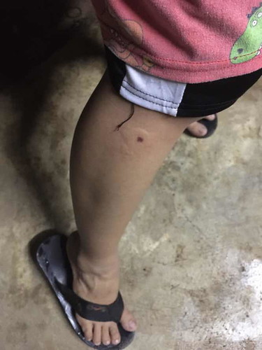ต่อหัวเสือต่อย
