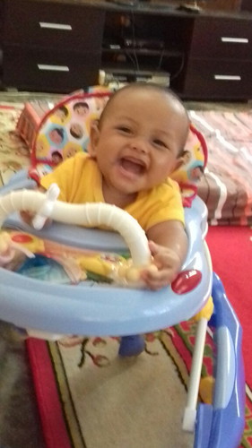 rambut rontok