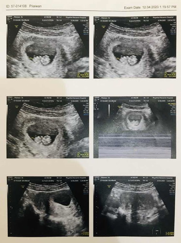 8W4D