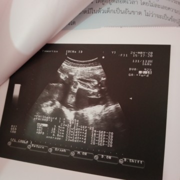 มีโอกาสจะได้ลูกสาวไหมคะ