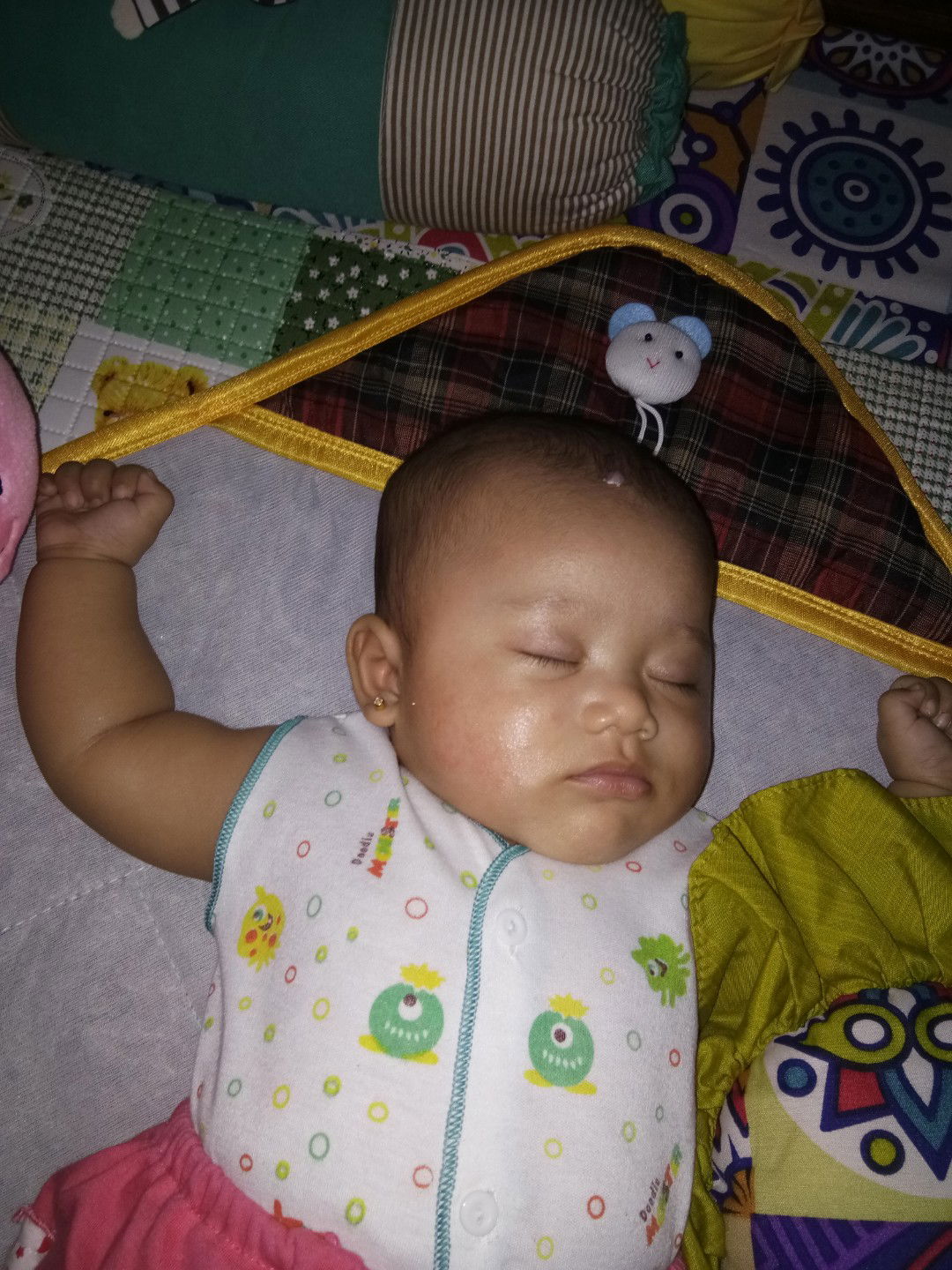 kemerahan pada pipi bayi