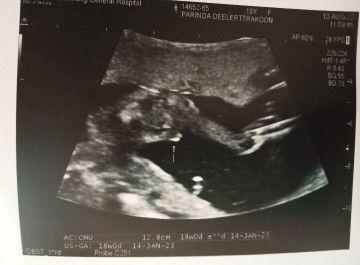 ช่วยดูเพศลูกหน่อยค่ะ