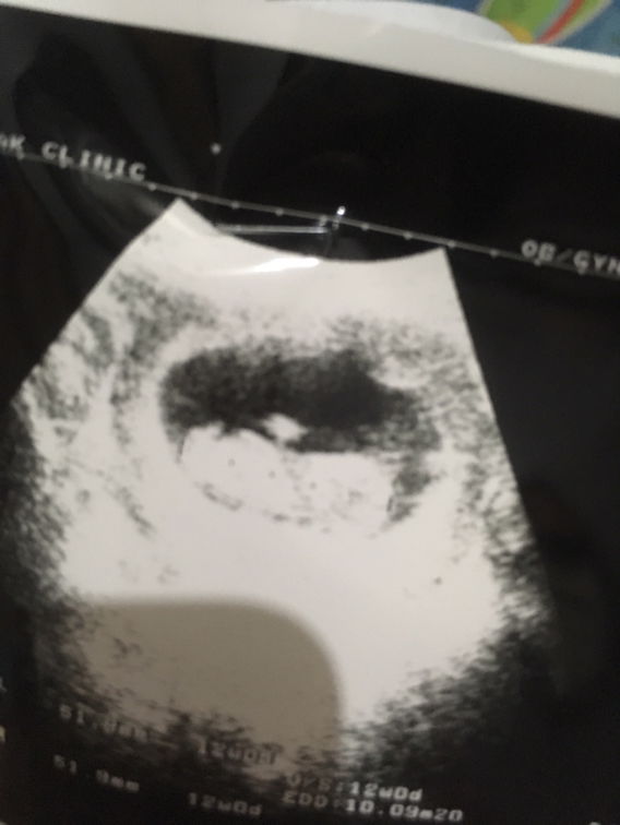 ชายหรือญคะเราดูไม่เป็นค่ะ