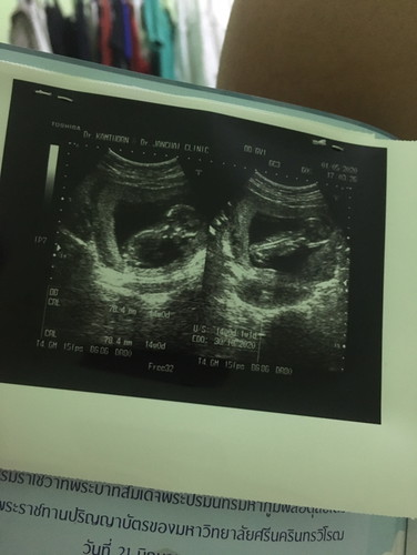 นอนคว่ำแบบนี้ลูกจะเป็นอะไรหรือเปล่าคะ. ไม่หันให้หมอดูเลย. 14 สัปดาห์ กังวลใจ. อันตรายหรือเปล่าคะ
