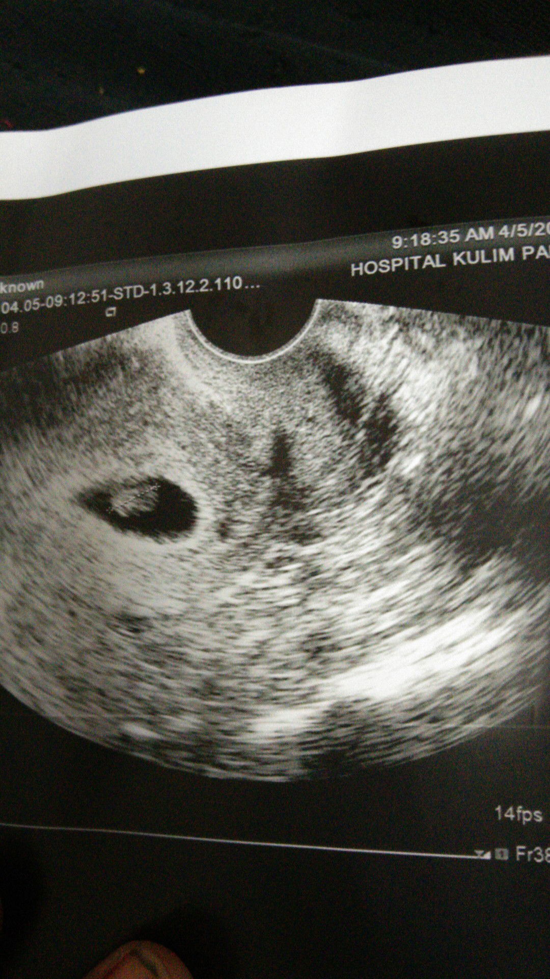 Nur Farhana profile icon