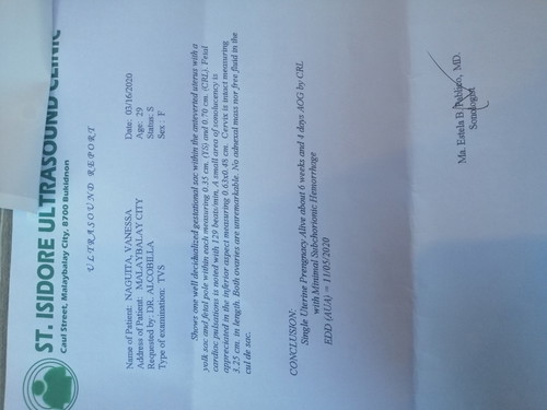 This is my result during my TVS.