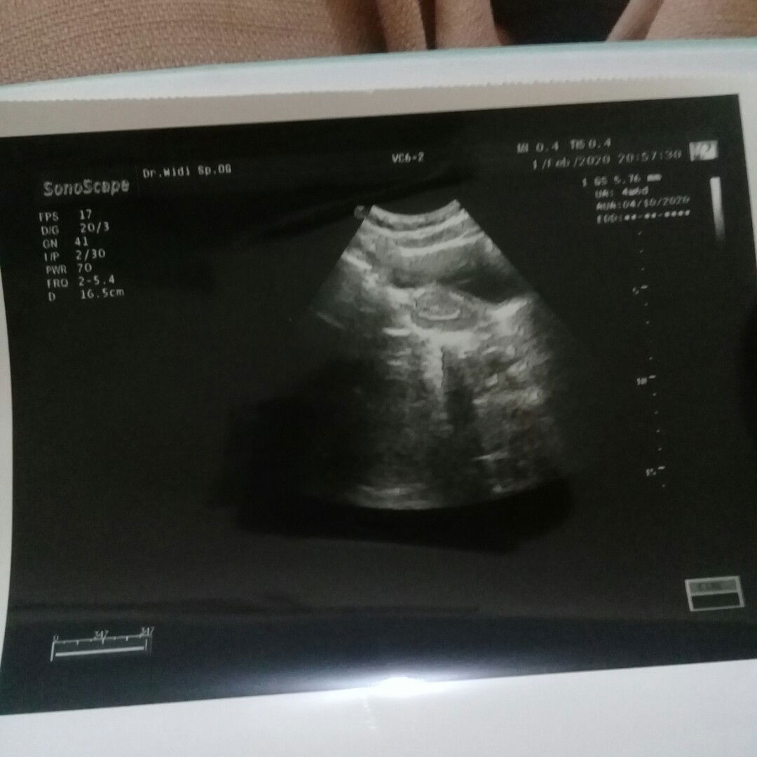 merry hardianti profile icon