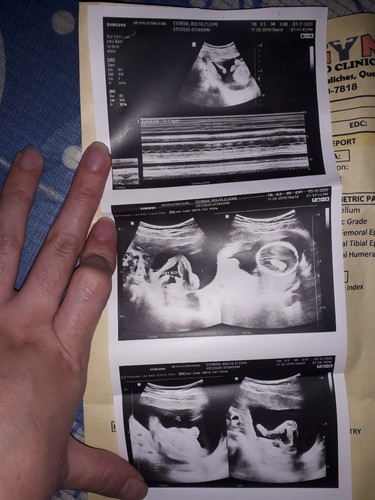 Sino po marunong mag basa ng Ultrasound result?