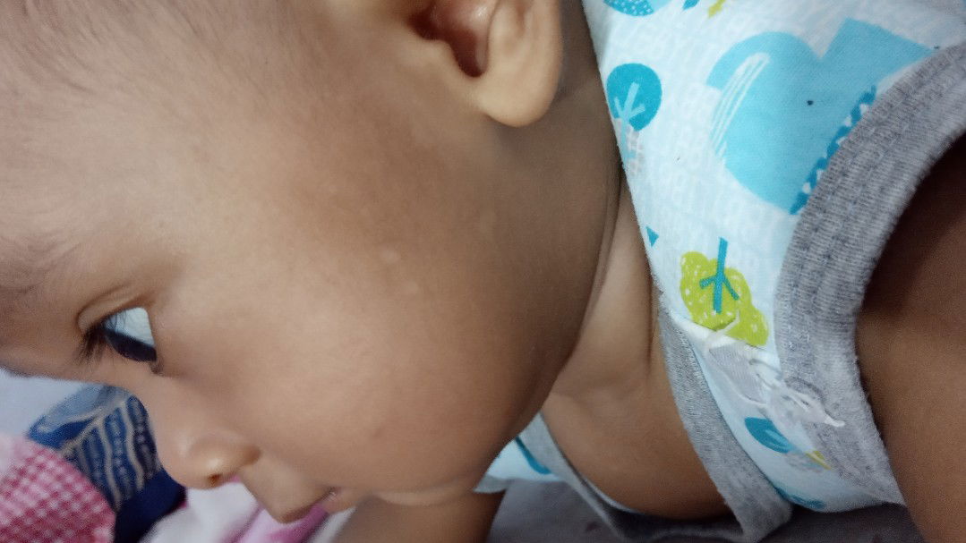 Bercak putih pada wajah & punggung