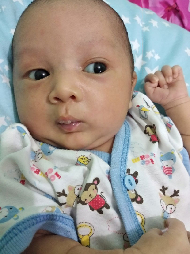 Bibir kering pada bayi