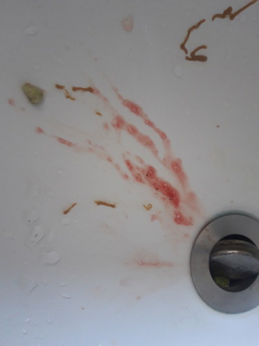 vomit blood