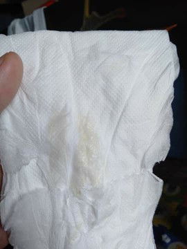 light yellow discharge