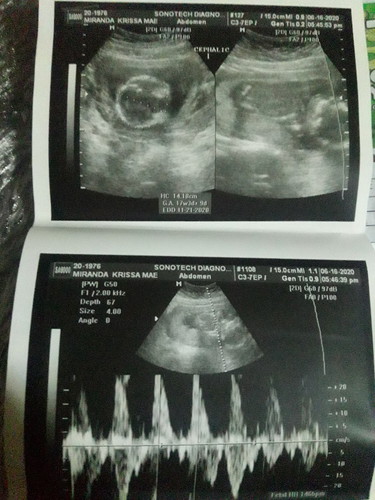 Gender of baby ❤️