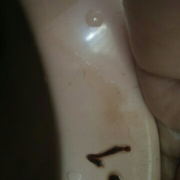 blood