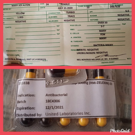 UTI safe ba ang cefalixine?