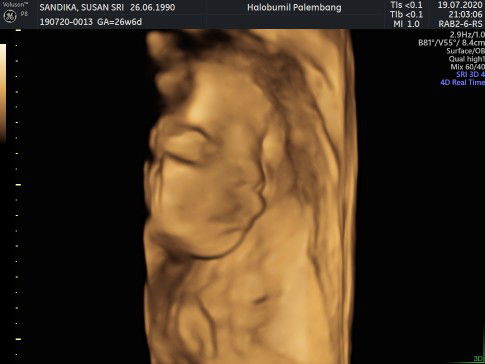 seorang ibu dari 3 anak profile icon