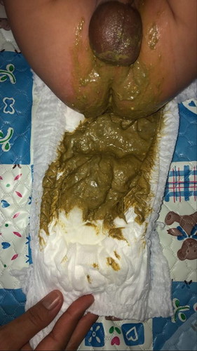 น้องทานนมผงสลับนมแม่แต่ เน้นนมผงเป็นหลักทุกๆ 2 ชม. น้องอายุ 2 เดือนค่ะ น้องจะถ่ายวันละครั้งหรือ เว้นวันถ่าย แต่จะถ่ายมากๆใน 1 ครั้ง แต่ครั้งนี้น้องถ่ายออกมามีสีเขียวขี้ม้า และเหนียวๆมีกลิ่นเหม็น