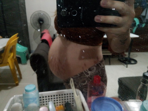 35weeks