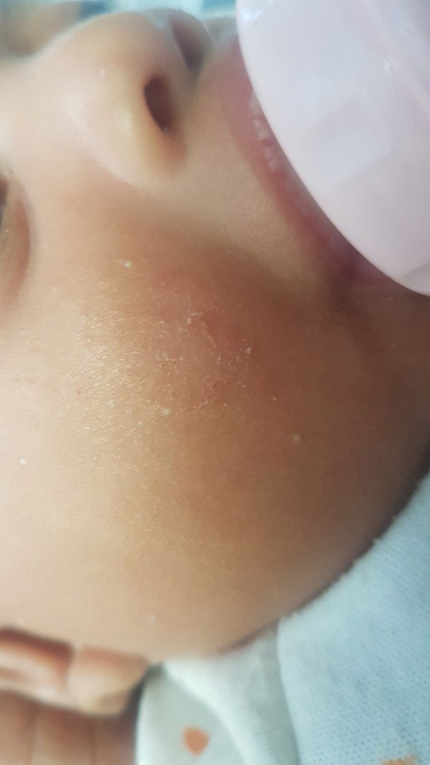 pipi kasar pada bayi