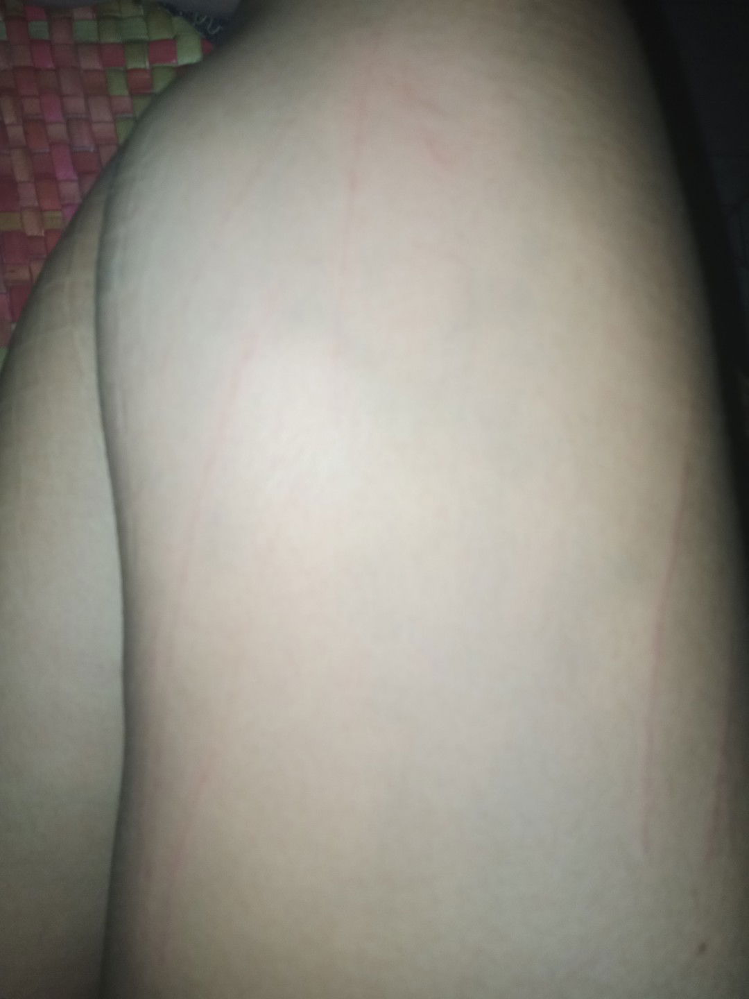 Normal po ba sa buntis ang lamig sa katawan? salamat p sa mga sasagot ??