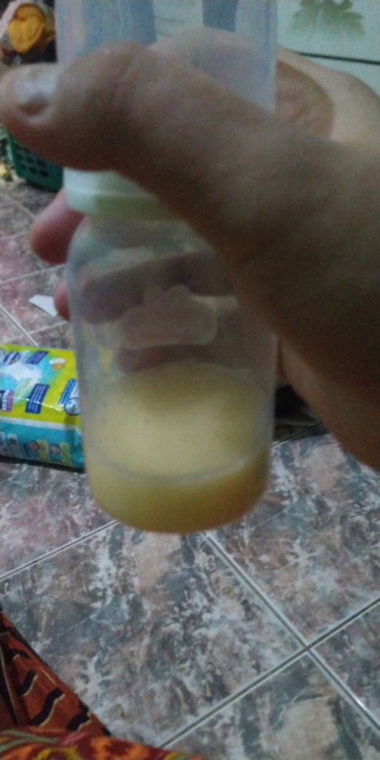 [SHARING] ASI TIDAK KELUAR PASCA MELAHIRKAN