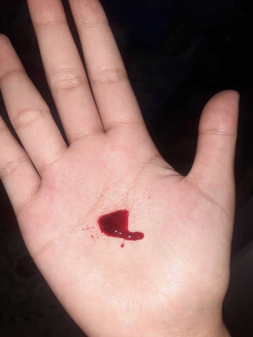 จะเป็นไรไหมค่ะ