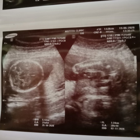 ดูตรงไหนค่ะว่าเพศอะไร