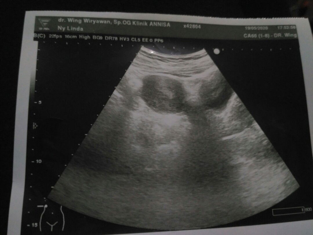 Pelajaran Besar  Buat Kedepanya