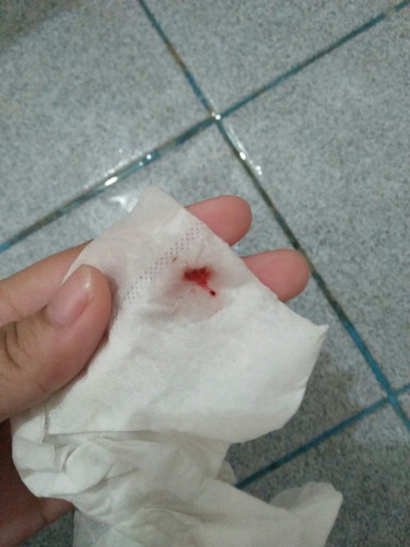เลือดออกตรงช่องคลอด