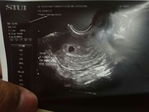5 weeks 6days