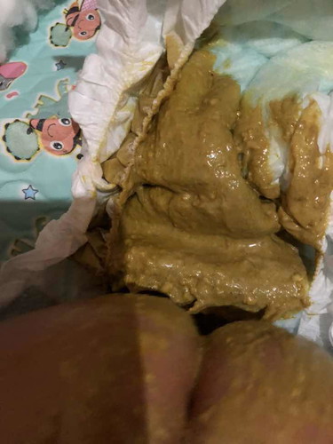 Poop