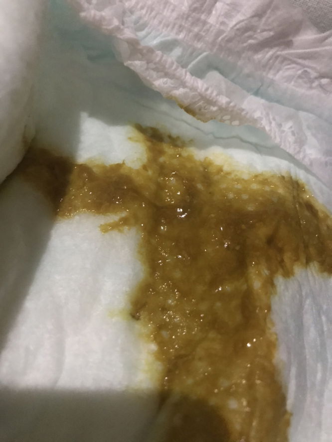 Ask ko lang poop ng 4mos and 26 days old