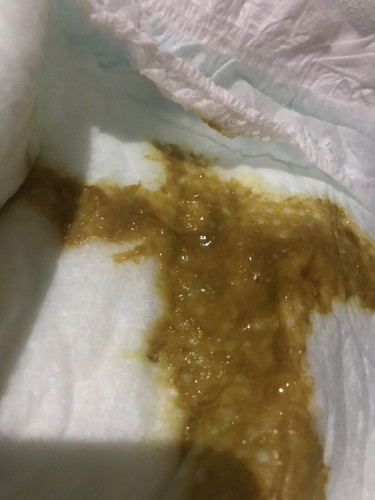 Ask ko lang poop ng 4mos and 26 days old