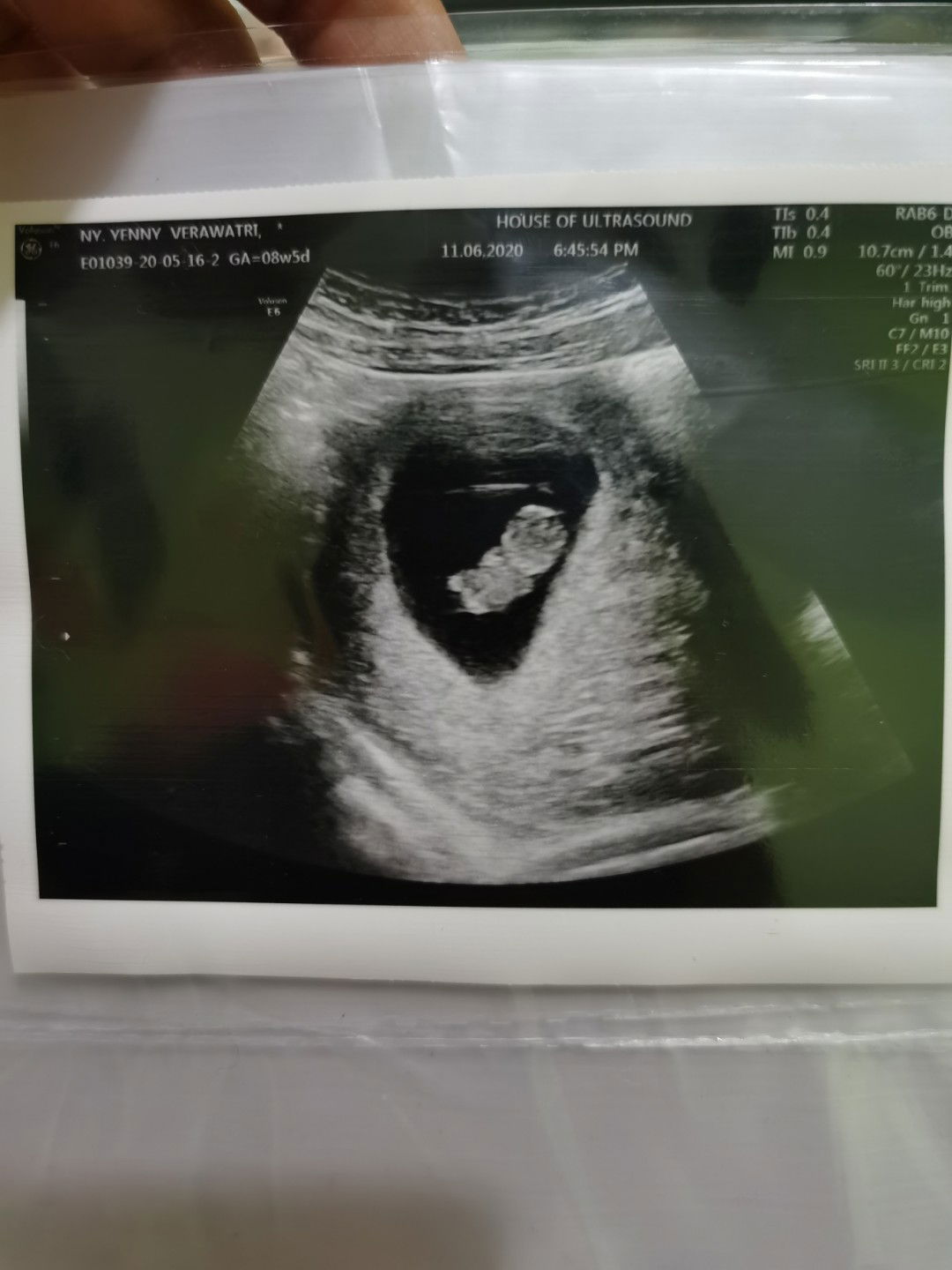 Berat janin sudah terlihat belum